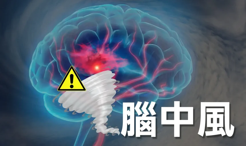 高血壓中風