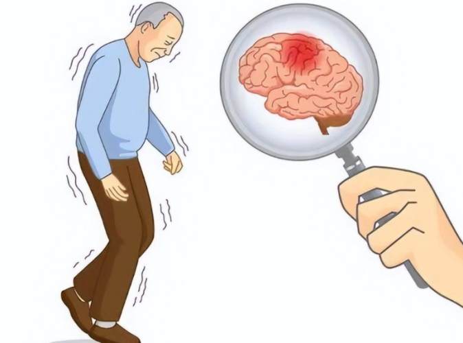 中風後遺症治療 中風後遺症治療