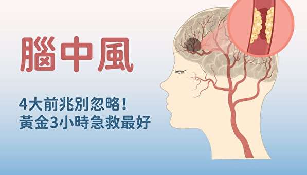 高血壓中風原因 高血壓中風原因
