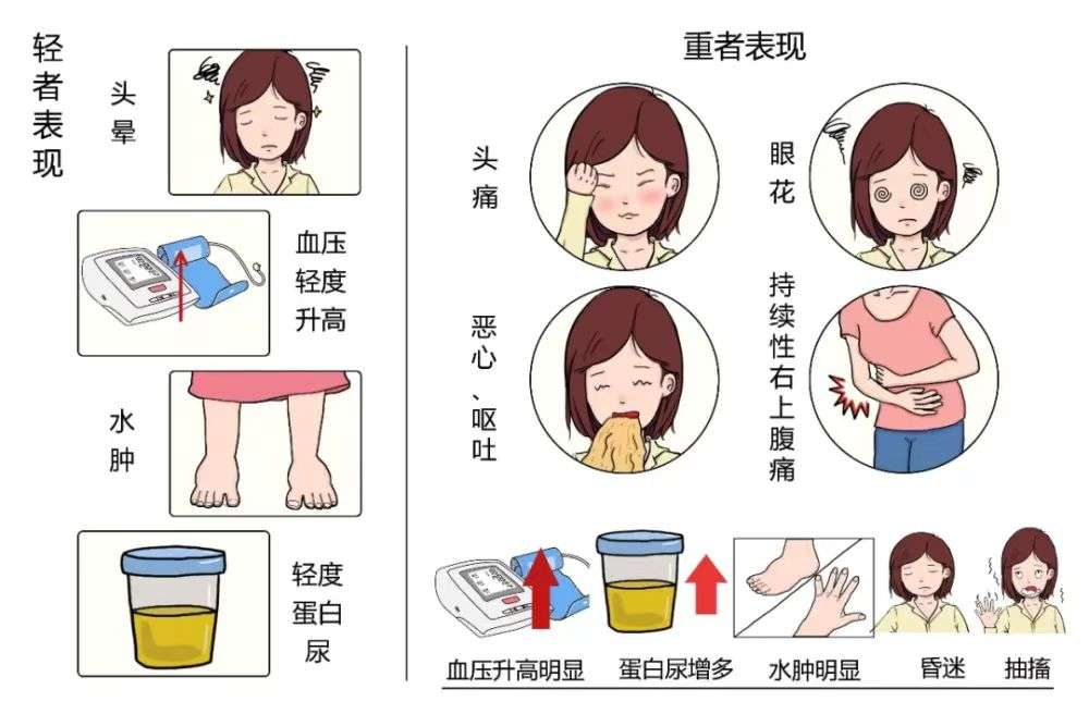 妊娠高血壓警示症狀