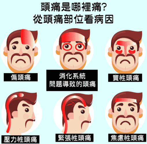 高血壓頭痛位置