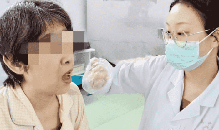 延腦中風治療